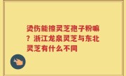 烫伤能擦灵芝孢子粉嘛？浙江龙泉灵芝与东北灵芝有什么不同
