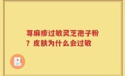 荨麻疹过敏灵芝孢子粉？皮肤为什么会过敏