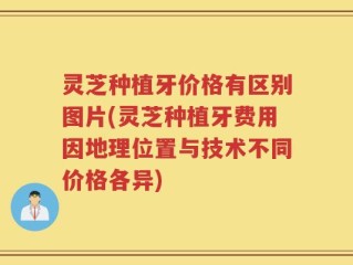 灵芝种植牙价格有区别图片(灵芝种植牙费用因地理位置与技术不同价格各异)