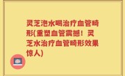 灵芝泡水喝治疗血管畸形(重塑血管震撼！灵芝水治疗血管畸形效果惊人)