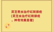 灵芝煮水治疗红斑狼疮(灵芝水治疗红斑狼疮，神奇效果显著)